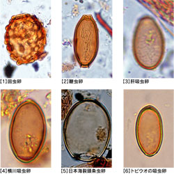 �񐶒����̎ʐ^�b1�񒎗��@2�ڒ����@3�̋z�����@4����z�����@5���{�C�����𒎗��@6�g�r�E�I�̋z����